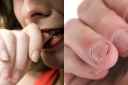 Chewing Nails Habit : आप भी अपने नाखूनों को चबाते हैं, तो हो जाएं सावधान हो सकती है ये गंभीर बीमारी