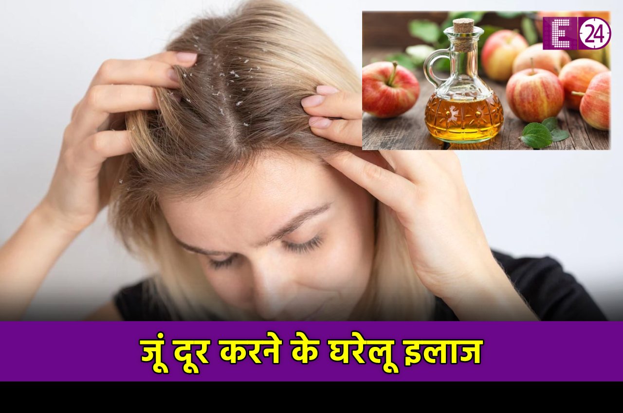  Hair Care Tips, Healthy Hair, Lice Removal Home Remedies