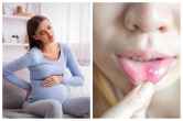 Home Remedies For Pregnancy Time, Health Tips For Women, Health Care, Tongue Sores Home Remedies