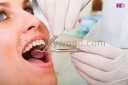 Teeth Problem, teeth problems in hindi, teeth problem solution teeth problems home remedies, Health Tips