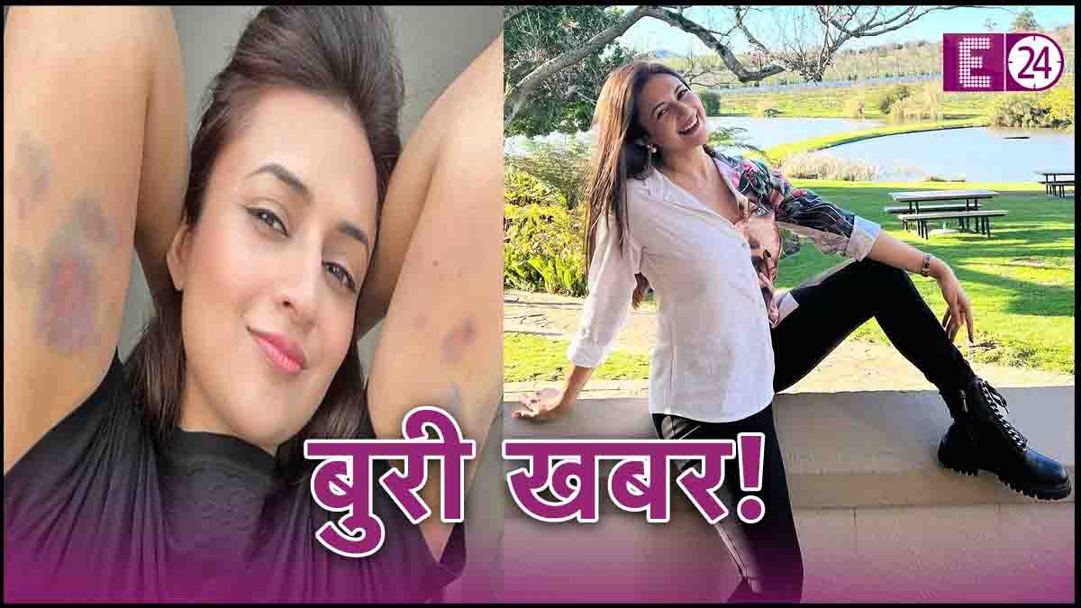 Divyanka Tripathi Injured