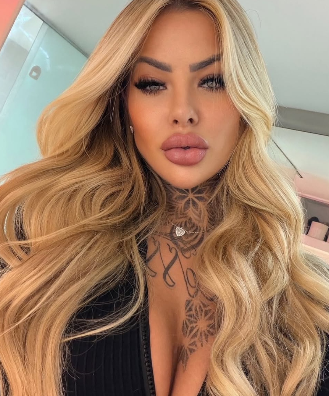 Social Media Influencer Dies After Plastic Surgery -1-2-3-4-5-6