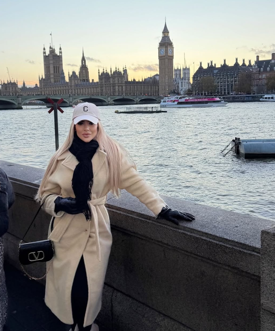 Social Media Influencer Dies After Plastic Surgery -1-2-3-4-5-6-7