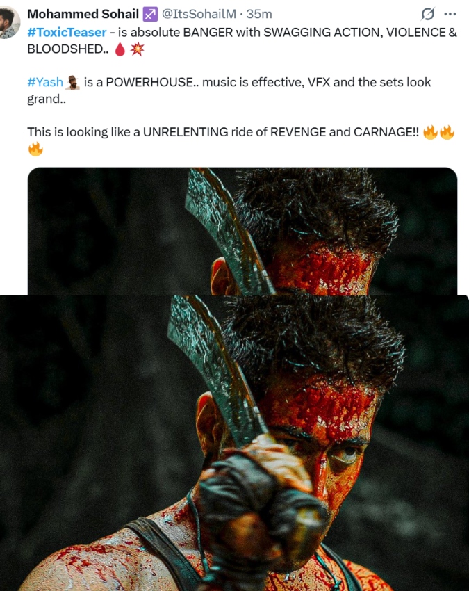 Toxic teaser review Toxic teaser review-1-2-3-4-5-6-7