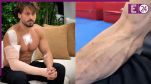 tiger shroff team shares injured hand video